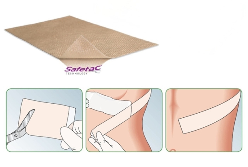 Scar Sheet - Molnlycke (Mepiform) 4x30cm