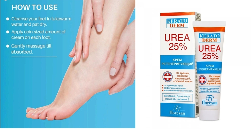 Keratoderm Urea 25